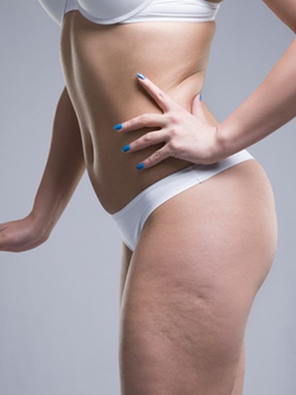 corporal-celulitis
