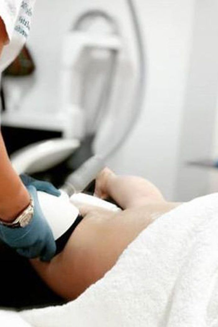 velashape (1)